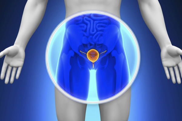 سبک زندگی و مراقبت های تکمیلی در کنار درمان سرطان پروستات