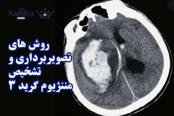 روش های تصویربرداری و تشخیص مننژیوم گرید ۳