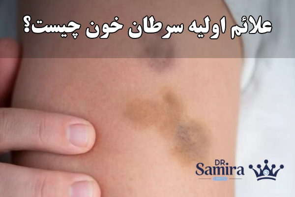 علائم اولیه سرطان خون