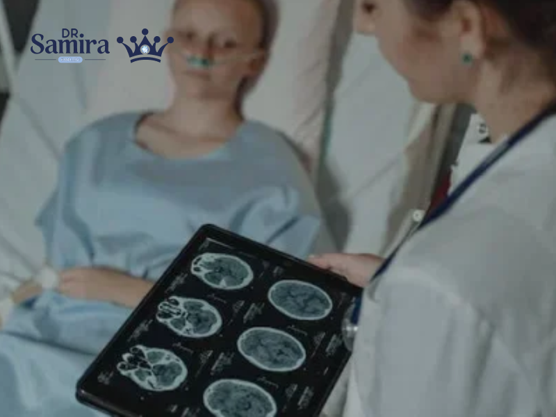 آستروسیتوم گرید ۳