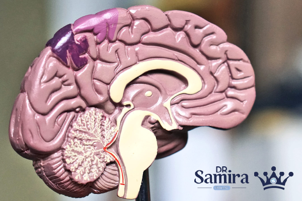 آستروسیتوم گرید ۴ چیست؟