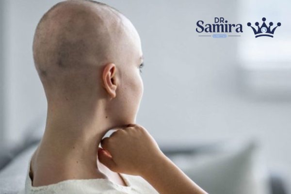 خطرات جدی و عوارض نادر قرص شیمی درمانی