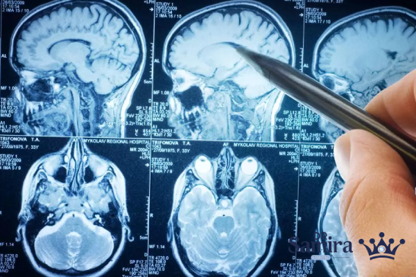 عوارض و مشکلات احتمالی