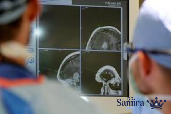 اپاندیموم گرید ۳ چیست؟