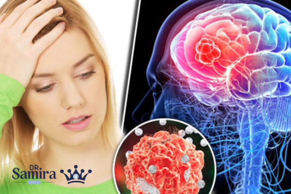 تفاوت الیگودندروگلیوم گرید ۳ با گرید ۲