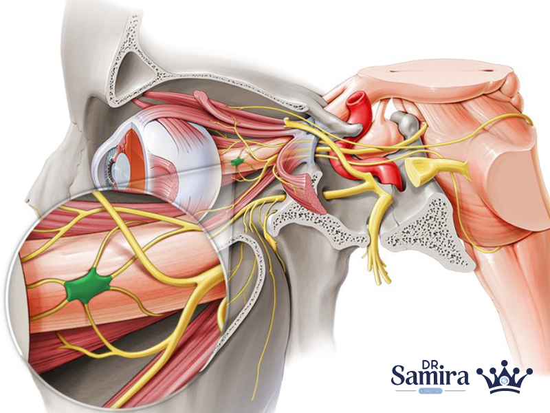 مننژیوم عصب اپتیک چیست؟