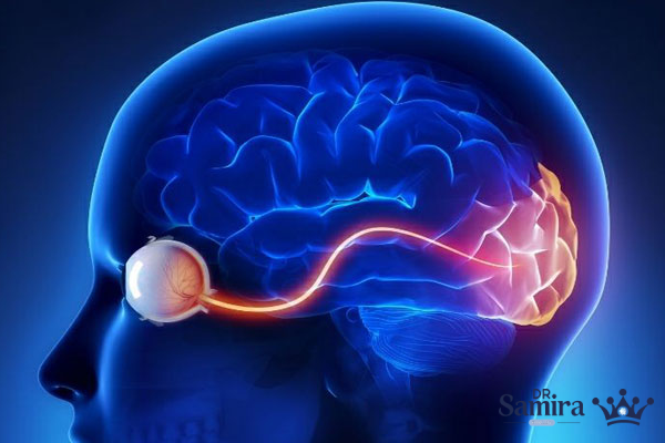 عوامل خطر آفرینی گلیوم عصب اپتیک