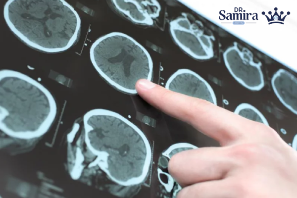 عوامل موثر بر پیش آگهی بیماران