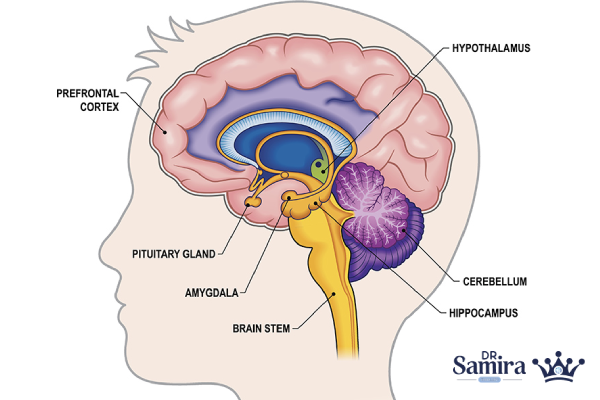 کیست آراکنوئید مغز چیست؟