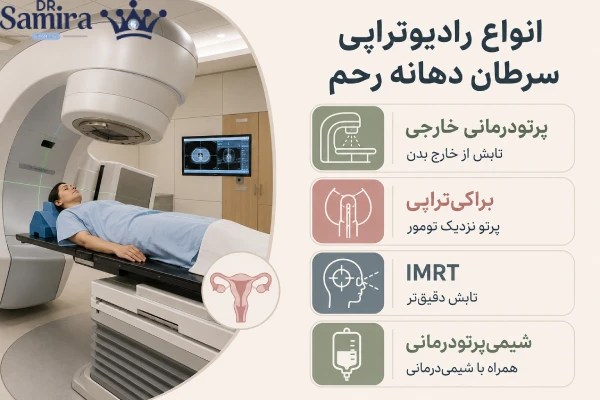 انواع رادیوتراپی سرطان دهانه رحم