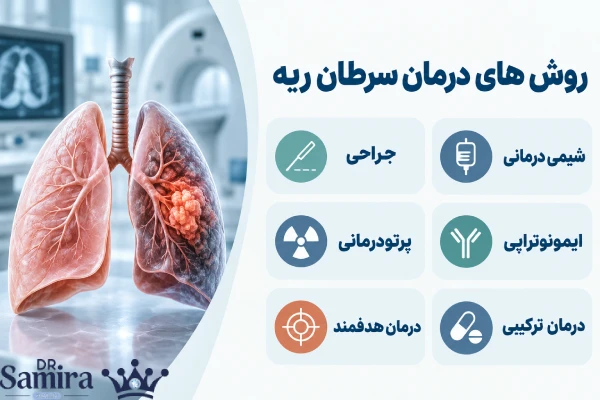 روشهای درمان سرطان ریه