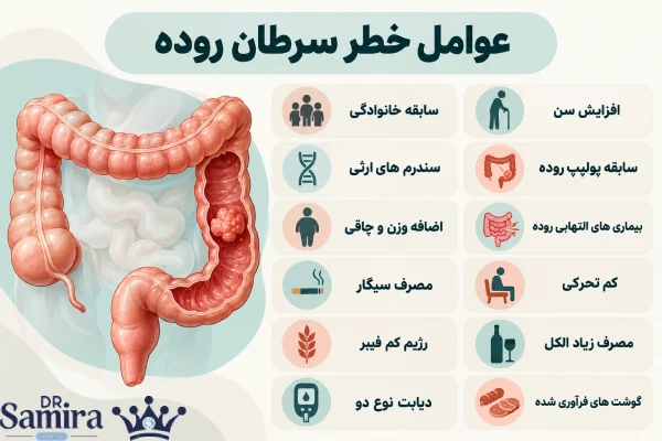 عوامل خطر سرطان روده