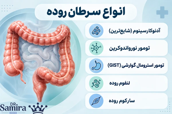 انواع سرطان روده